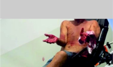 Homem  é esfaqueado em Petrolina de Goiás;  autor é preso e conduzido para Jaraguá